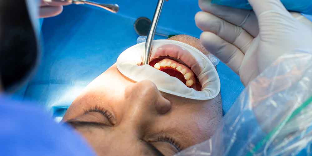 Unlocking the Potential: The Power of Dental Treatment for Oral Health