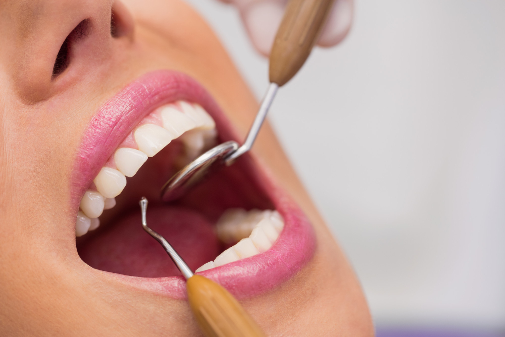 How to Brush Your Teeth Properly: A Step-by-Step Guide