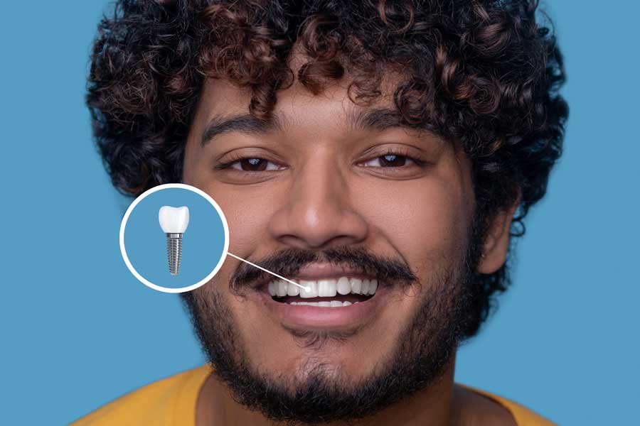 Understanding the Dental Transplant Procedure: A Comprehensive Guide
